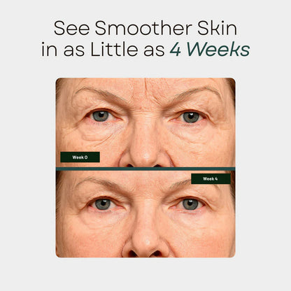 🔥Buy 1 Get 1 Free🔥Beauty Patches