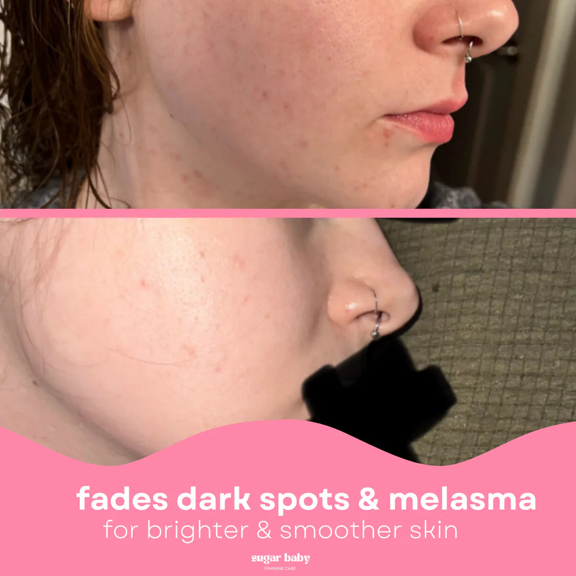 Glass Skin Kit + FREE Glow Serum