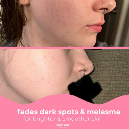 Glass Skin Kit + FREE Glow Serum