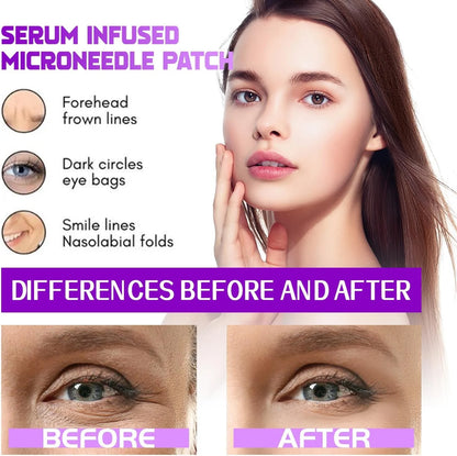 Micro Eye Patches, Under Eye Patches for Puffy Eyes and Dark Circles