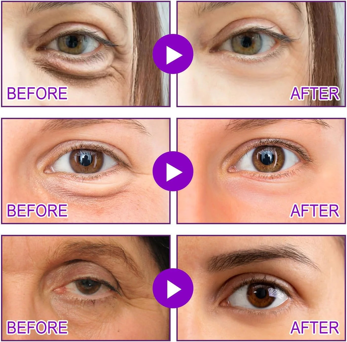 Micro Eye Patches, Under Eye Patches for Puffy Eyes and Dark Circles