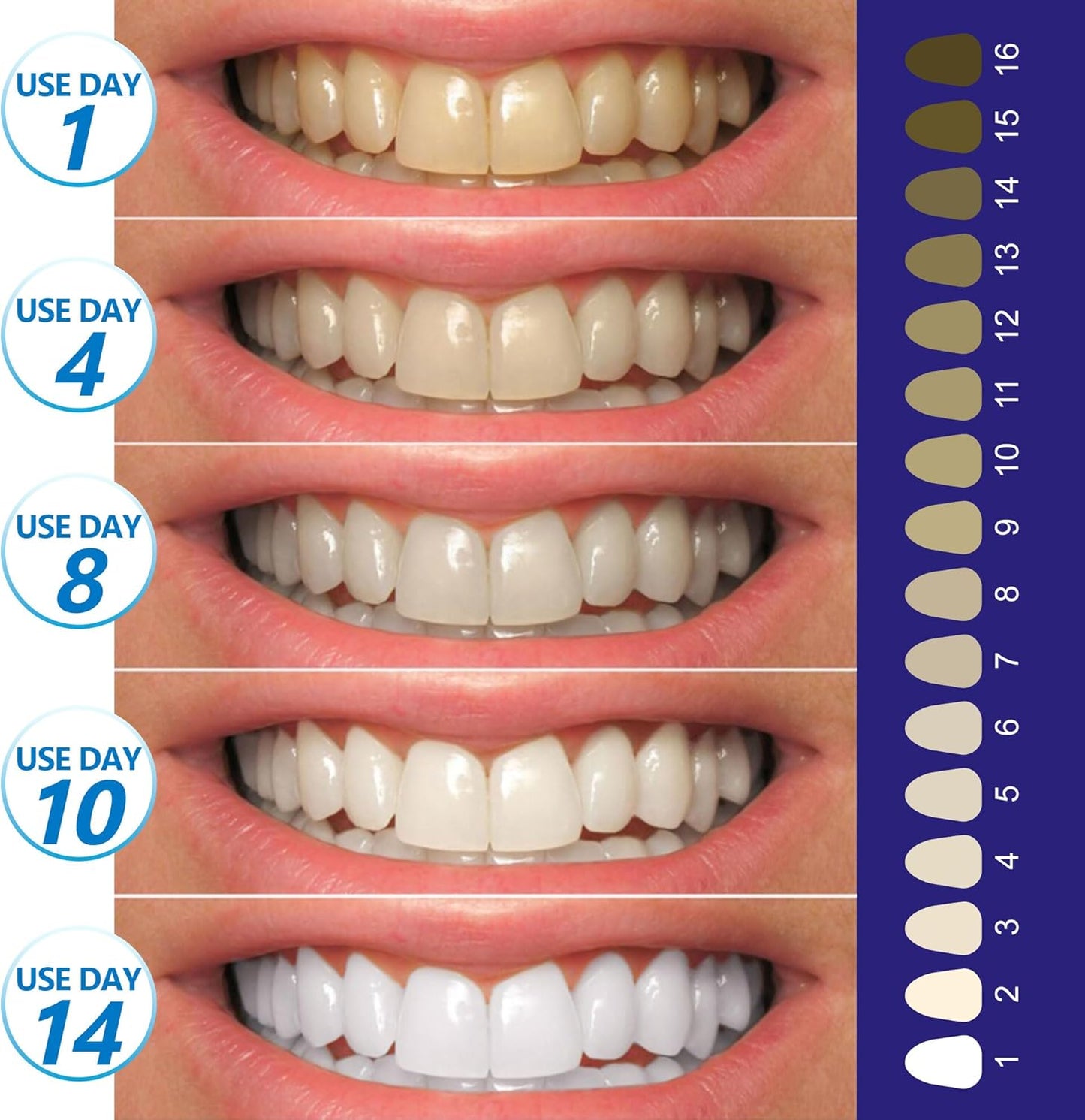 🦷 "Ditch the Sensitivity! Safe Whitening Strips That Actually Work – 28 Count"