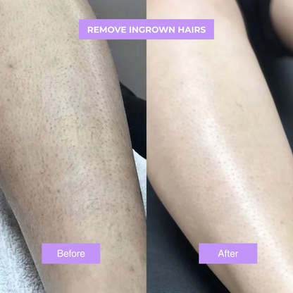 Cyperus Rotundus Skin Serum