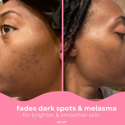 Glass Skin Kit + FREE Glow Serum