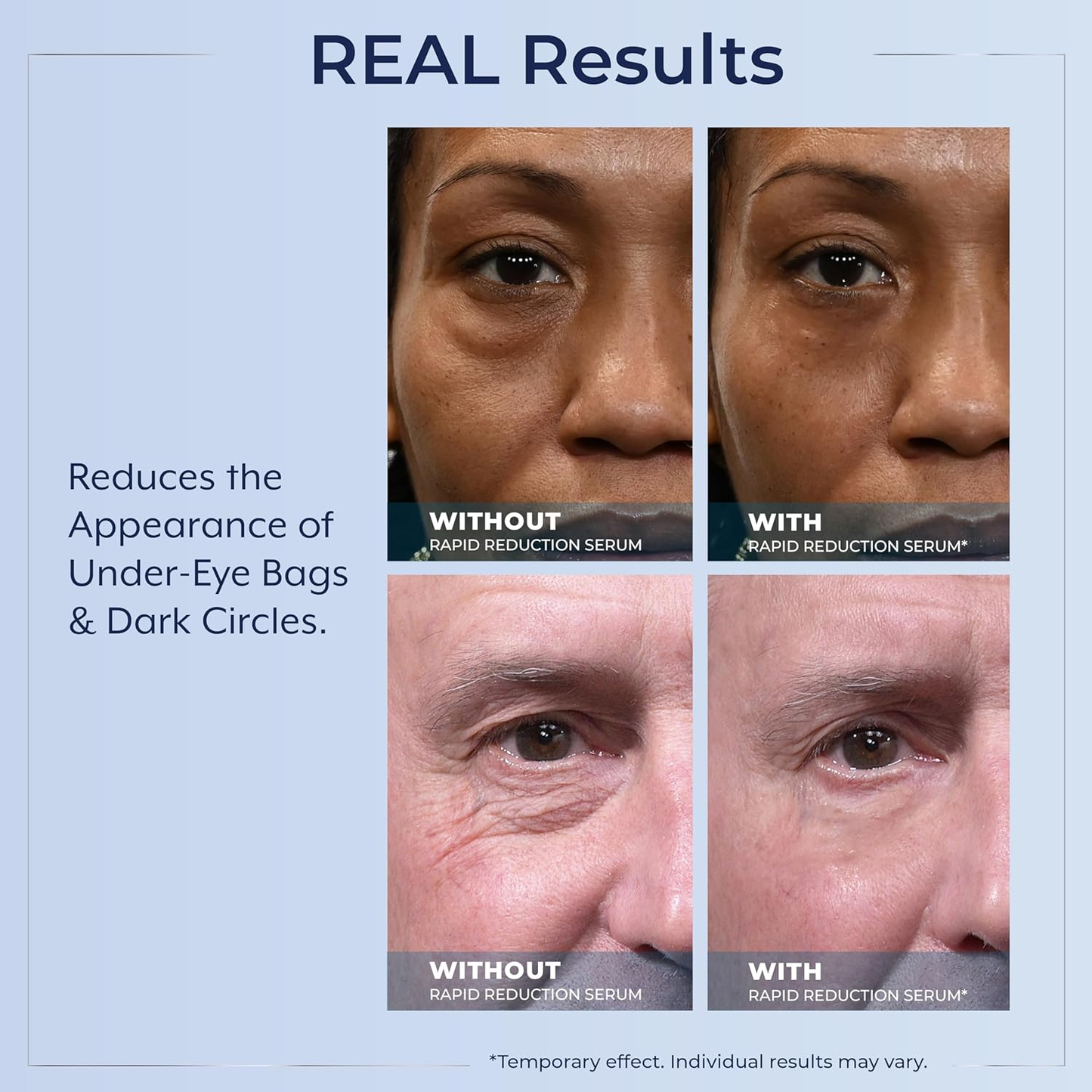 Rapid Reduction Wrinkle Serum