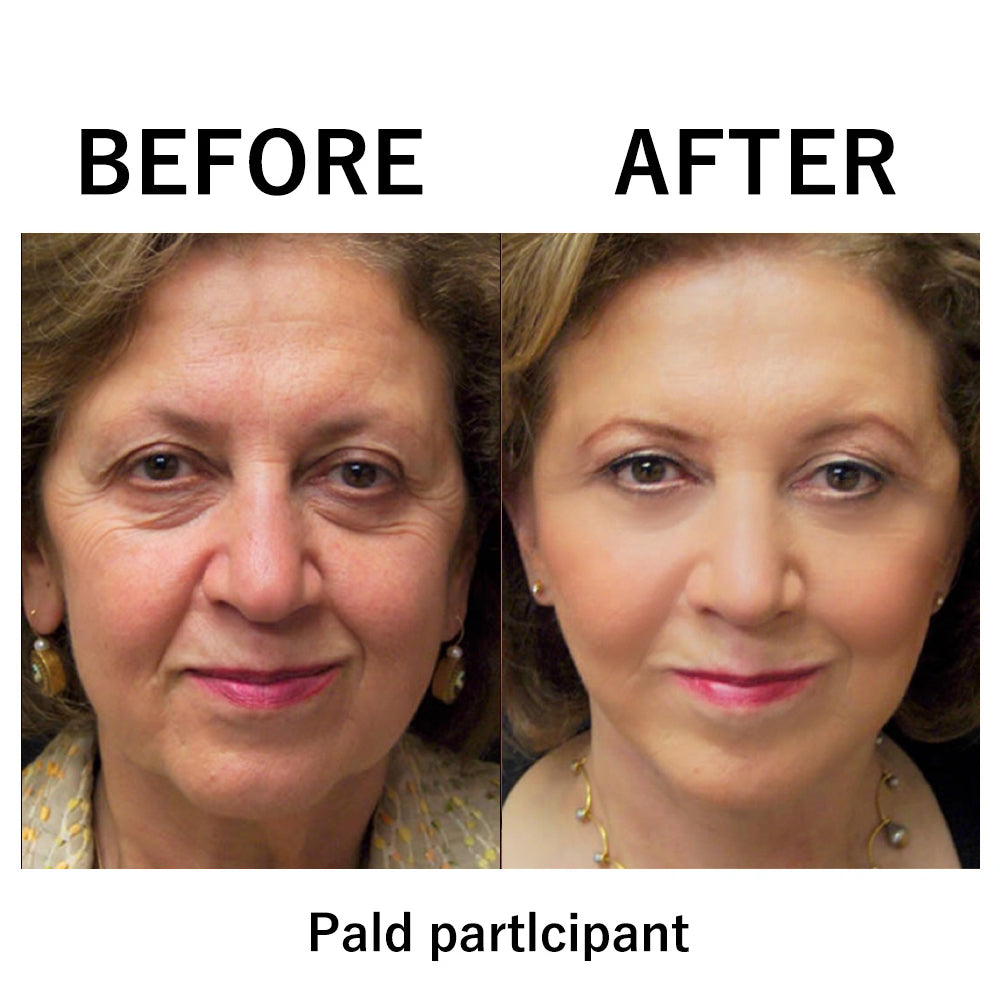 🔥 Last Day Discount 🔥Instant Temporary Face Tightener