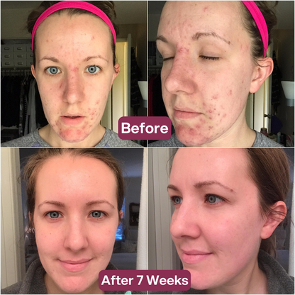 Advanced Snail 96 Mucin Face Mask