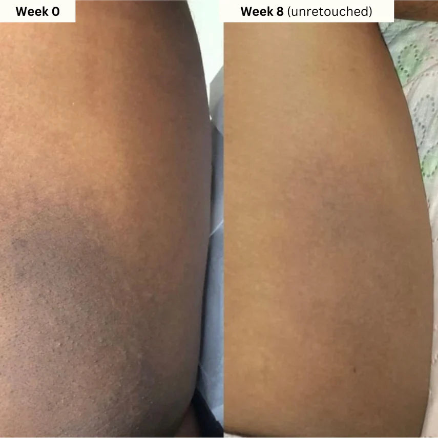 Turmeric & Kojic Acid Body Cream