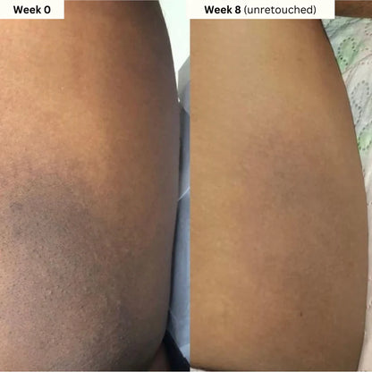 Turmeric & Kojic Acid Body Cream