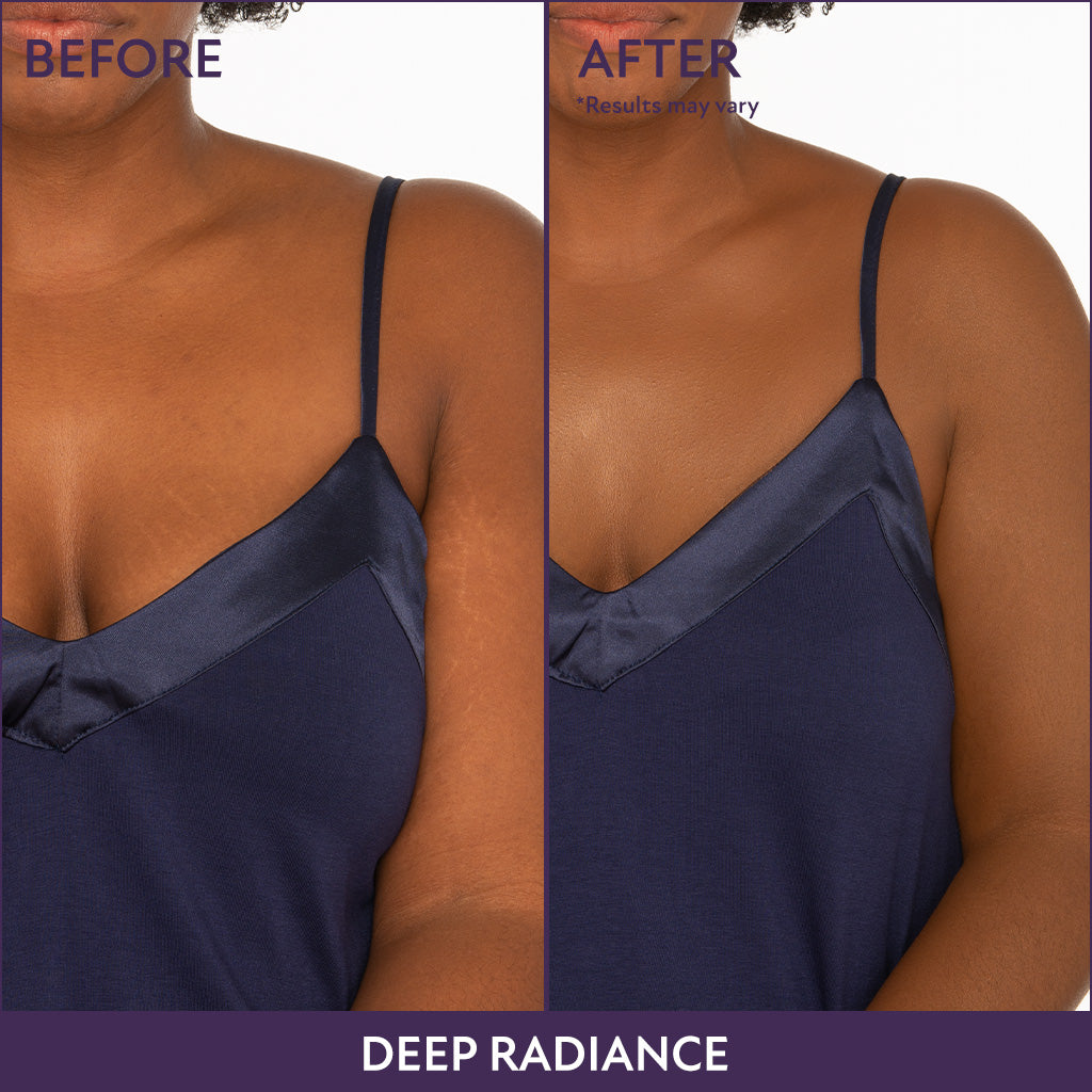 Final 3 Hours [ 70% OFF ]: Beauty Body Coverage Perfector with Brush