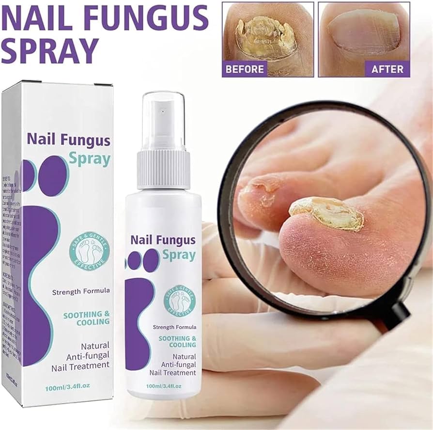 🔥Limited time offer 🔥PLANT-BASED ANTI-FUNGAL SPRAY (Clinically Approved)