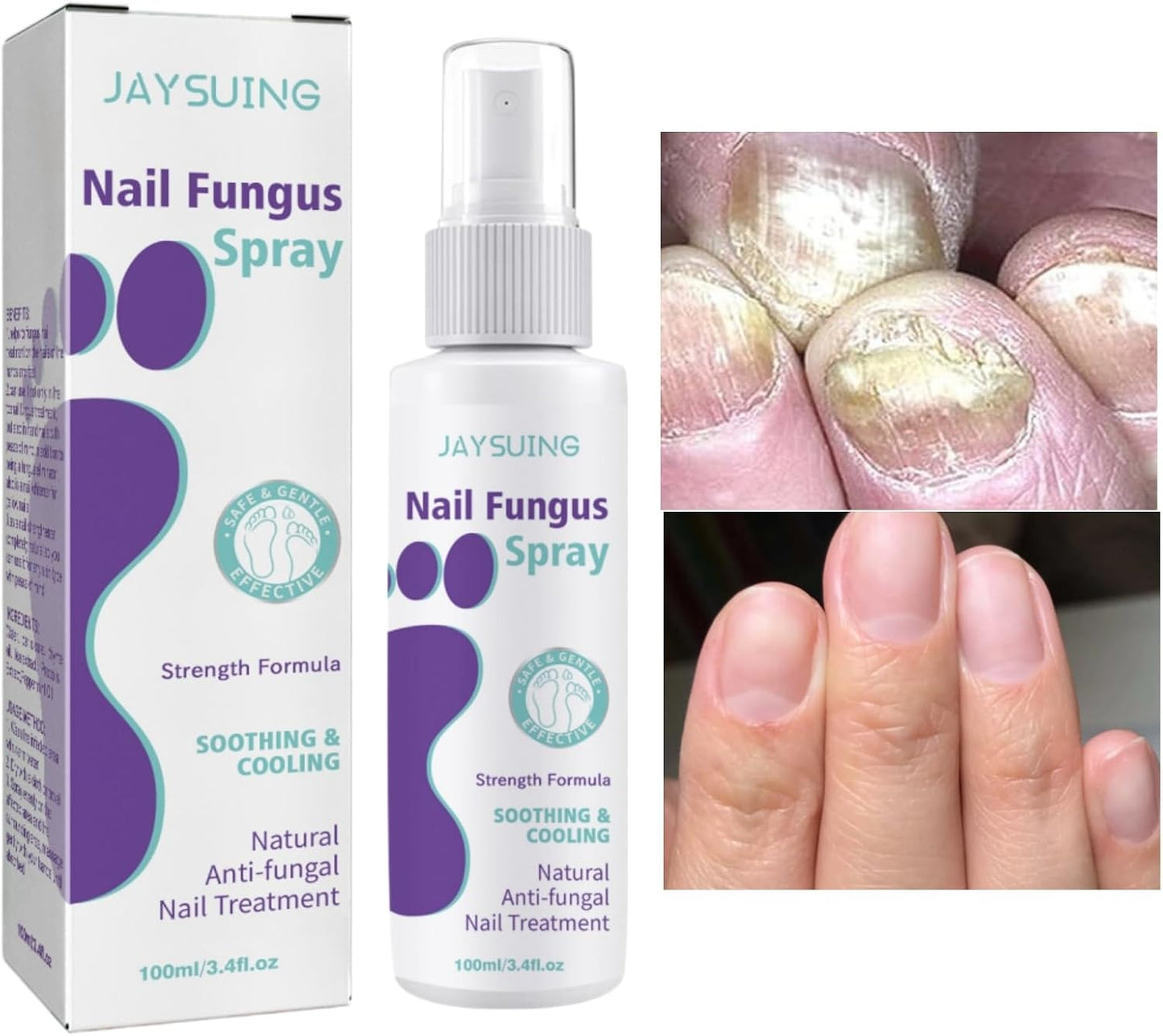 🔥Limited time offer 🔥PLANT-BASED ANTI-FUNGAL SPRAY (Clinically Approved)
