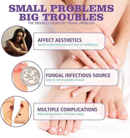 🔥Limited time offer 🔥PLANT-BASED ANTI-FUNGAL SPRAY (Clinically Approved)