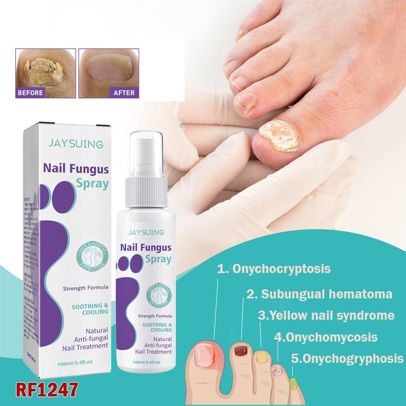 🔥Limited time offer 🔥PLANT-BASED ANTI-FUNGAL SPRAY (Clinically Approved)
