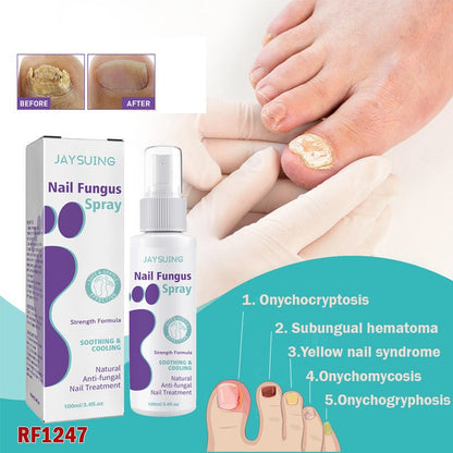 🔥Limited time offer 🔥PLANT-BASED ANTI-FUNGAL SPRAY (Clinically Approved)