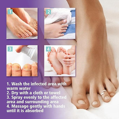 🔥Limited time offer 🔥PLANT-BASED ANTI-FUNGAL SPRAY (Clinically Approved)