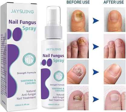 🔥Limited time offer 🔥PLANT-BASED ANTI-FUNGAL SPRAY (Clinically Approved)