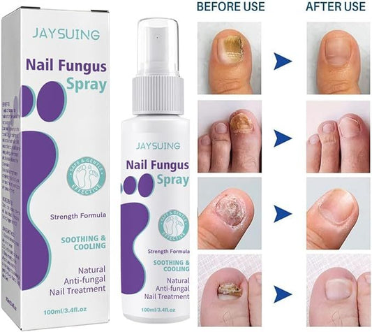 🔥Limited time offer 🔥PLANT-BASED ANTI-FUNGAL SPRAY (Clinically Approved)