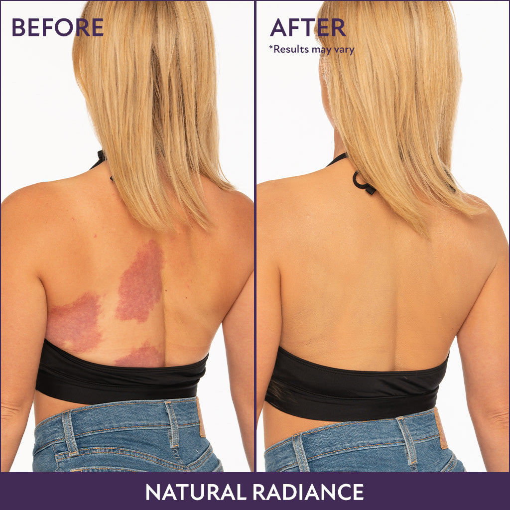 Final 3 Hours [ 70% OFF ]: Beauty Body Coverage Perfector with Brush