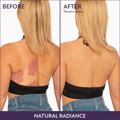 Final 3 Hours [ 70% OFF ]: Beauty Body Coverage Perfector with Brush