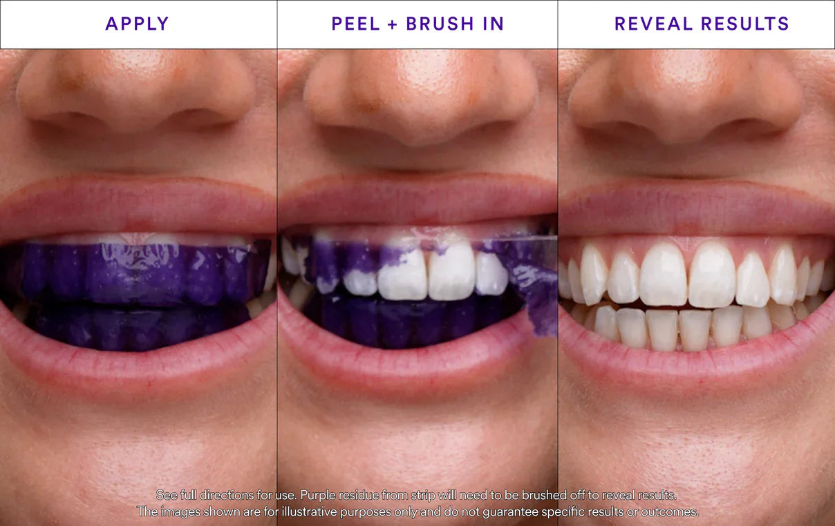 Whitening Strips: ‘’The Fast Track to a Stunning Smile!‘’✨