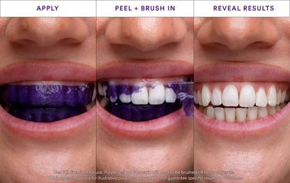 Whitening Strips: ‘’The Fast Track to a Stunning Smile!‘’✨