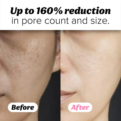 Peel Shot Glow Rice