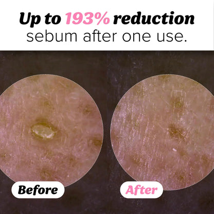 Peel Shot Glow Rice