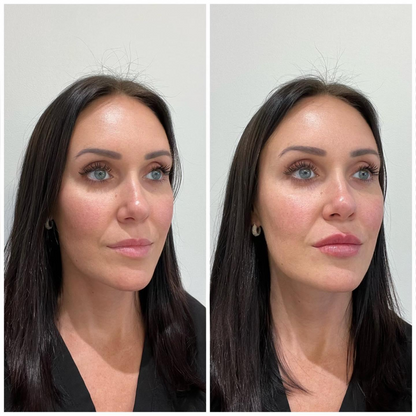 Lip Plumper gloss lips