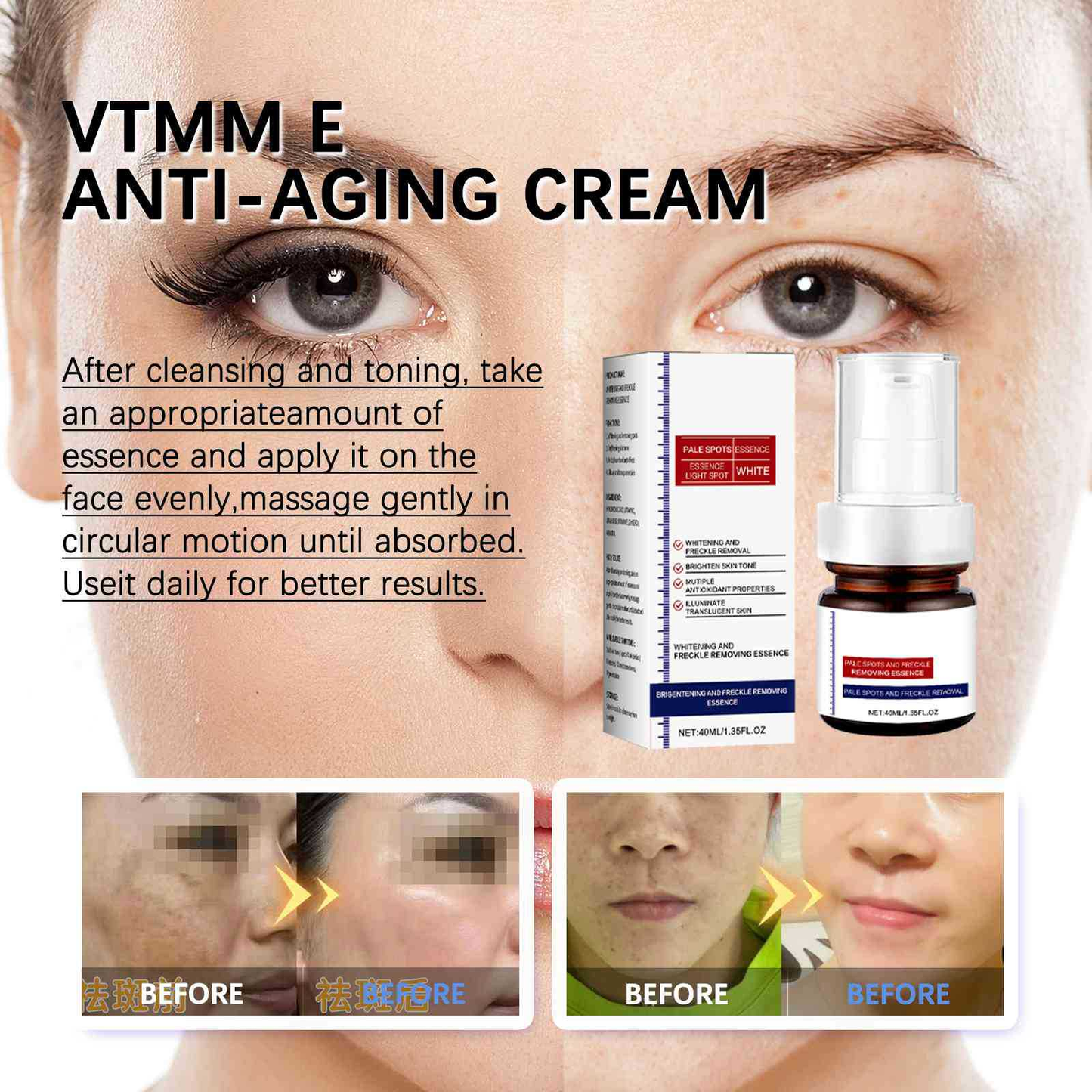 Anti Aging Moisturizer Face Cream for Women & Men,Whitening and Freckle Removing Essence