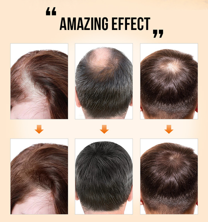 💥Natural Hair Density Essential Oil💥Limited-time offer❗