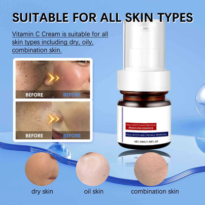Anti Aging Moisturizer Face Cream for Women & Men,Whitening and Freckle Removing Essence