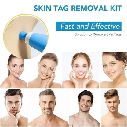 Auto Skin Tag Removal Kit